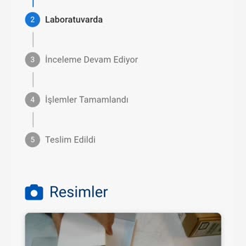 Isınan Telefon, Kayıp Kargo Ve İkinci El Şüphesi