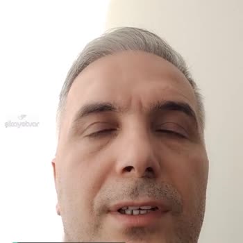 Denizbank Kredi Kartı Limit Azaltılmasında Zorluk Çıkarılması!