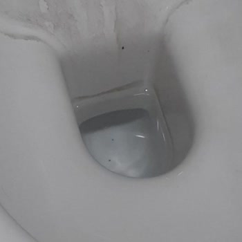 Yeni Taşındığım Evdeki Tuvalet Lekelenmesi Sorunu