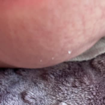 Bebek Bezinde Şeffaf Parçacık Şoku