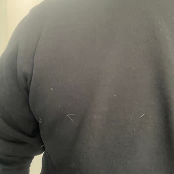 Adidas Montumun Tüy Sorunu Ve Garanti Mağduriyeti