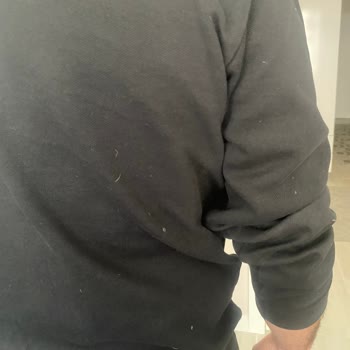 Adidas Montumun Tüy Sorunu Ve Garanti Mağduriyeti