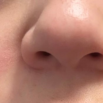 Cilt Ürünleri Egzama Ve Kaşıntıya Sebep Oldu