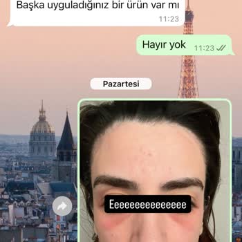 Altın İğne Uygulaması Sonrası Mağduriyet