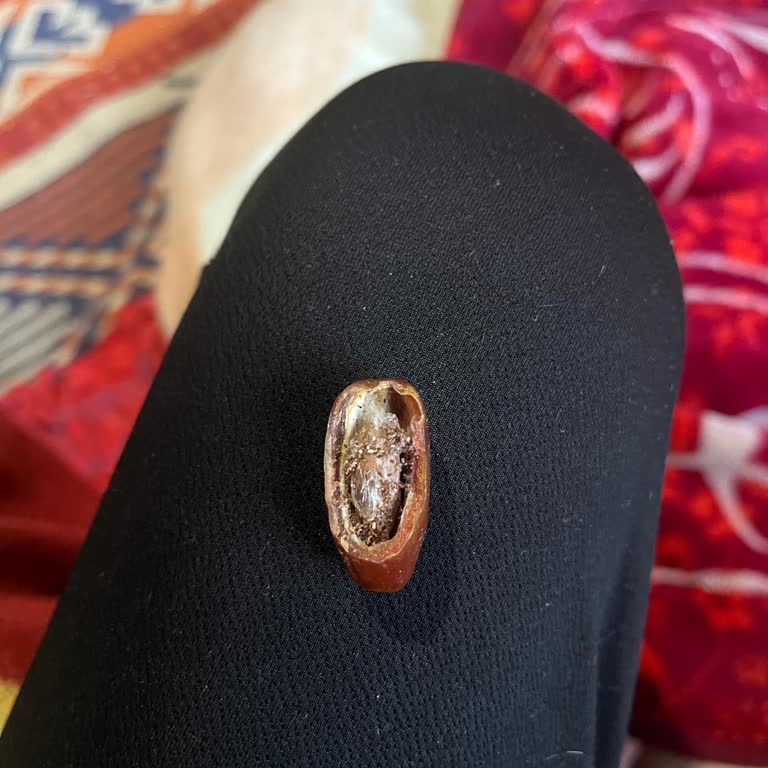 Hakmar Gıda Kurtlu Hurma Şoku: Hakmar'dan Beklenmedik Deneyim