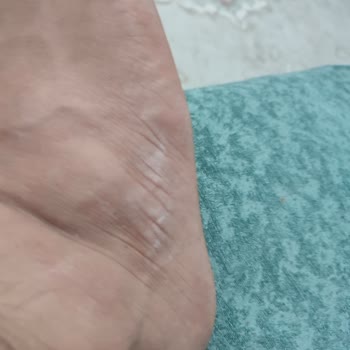 Adidas İade Sürecinde 40 Günlük Bekleyiş Ve Müşteri Hizmetleri Sorunu