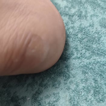 Adidas İade Sürecinde 40 Günlük Bekleyiş Ve Müşteri Hizmetleri Sorunu