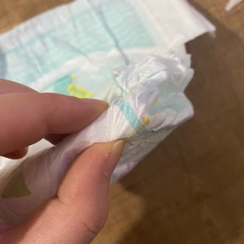 Kusurlu Bebek Bezi İle Bebek Sağlığı Riski