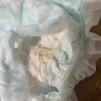 Kusurlu Bebek Bezi İle Bebek Sağlığı Riski