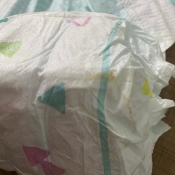 Kusurlu Bebek Bezi İle Bebek Sağlığı Riski