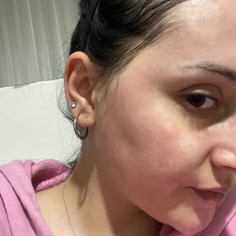 A101'den Aldığım Kil Maskesi Yüzümde Yanıklar Oluşturdu