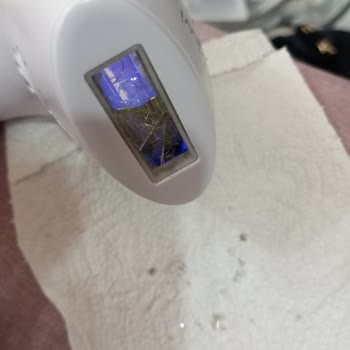 Cihazın Ekranı Patladı Ve Cildime Zarar Verdi