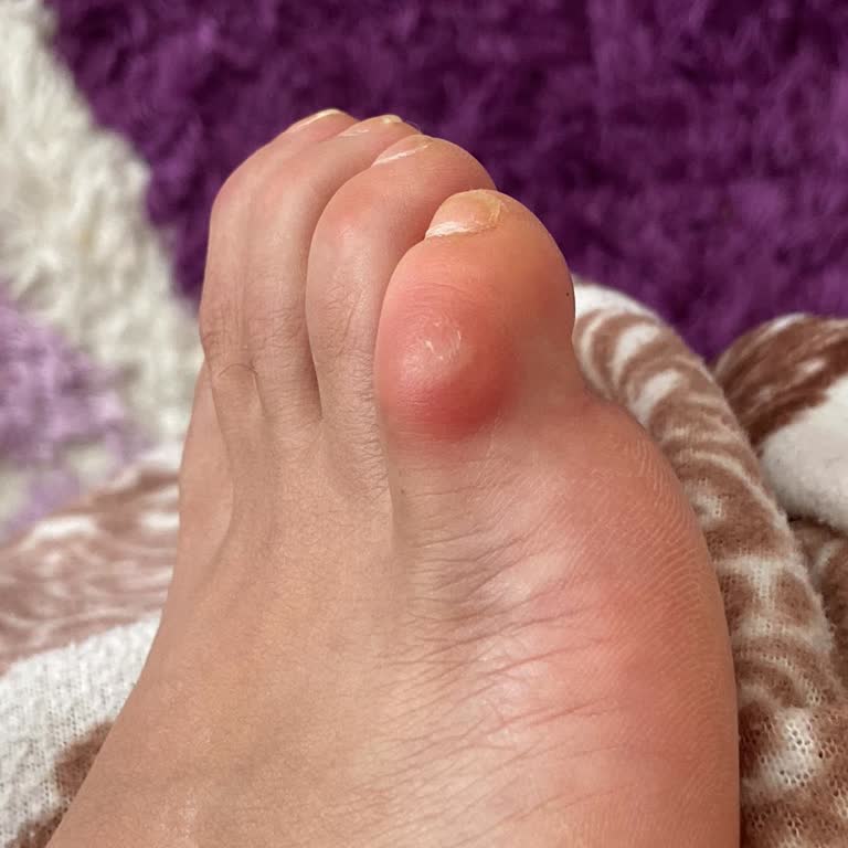 Trendyol'dan Aldığım Ayakkabı Ayağımı Yaraladı Ve İade Sürecinde Sorun Yaşıyorum