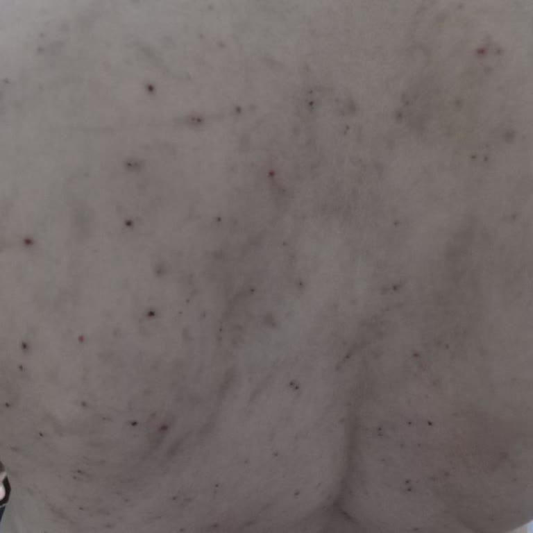 Erdem Hastanesi Hasta Haklarına Saygısızlık Ve Yetersiz Tedavi Deneyimi