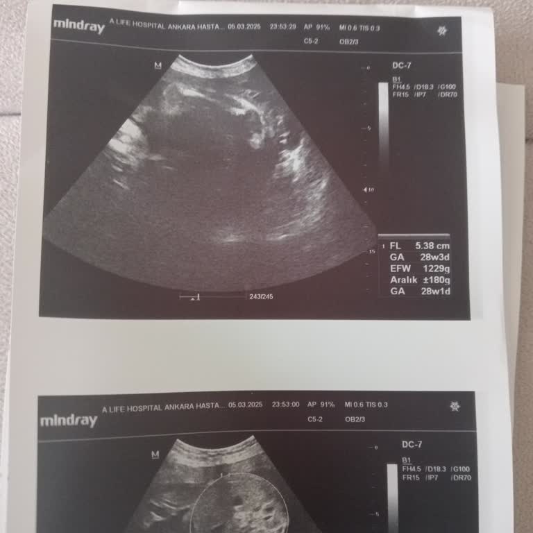 Özel Hastanede Beklenmedik Tavır Ve İlgisizlik