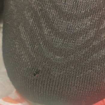 Asics Ayakkabının Beklenmedik Yırtılması