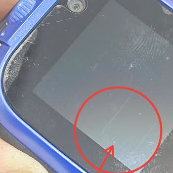 Ölü Piksel Sorunu Ve Yanıltıcı Servis Raporu