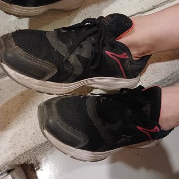 Ayakkabının Hızla Yıpranması Ve Destek Eksikliği