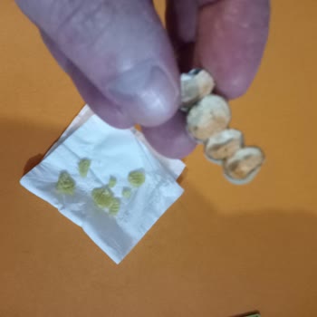 Lays Fırından Cips Dişimi Kırdı, Sağlık Riski Taşıyor!