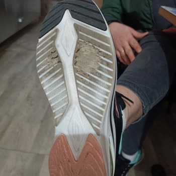 Skechers Ayakkabılarda Erken Taban Aşınması Sorunu