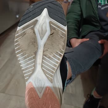 Skechers Ayakkabılarda Erken Taban Aşınması Sorunu