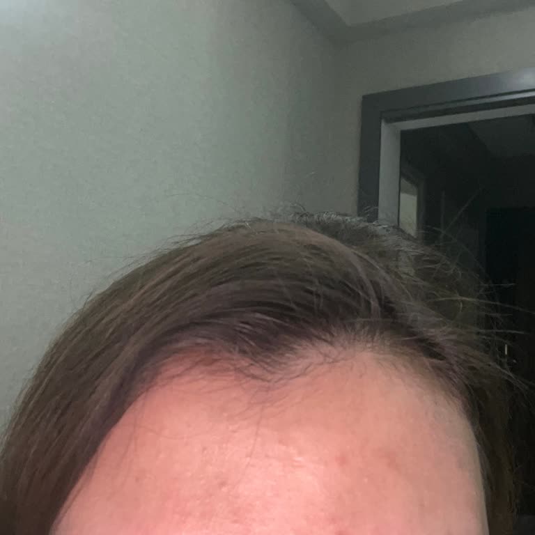 Medik8 C Vitamini Serumu Hayal Kırıklığı Yarattı