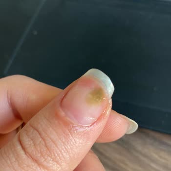 Emine Kızılağıl Beauty 1 Hafta Boyunca Acı Çektim