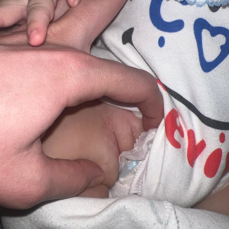 Molfix Bezleri Sızıntı Ve Pişik Sorunu Yaşatıyor