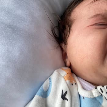 Islak Mendil Kullanımı Sonrası Cilt Sorunları