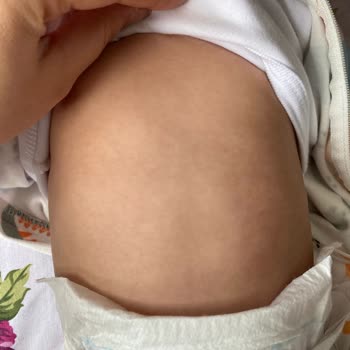 Islak Mendil Kullanımı Sonrası Cilt Sorunları