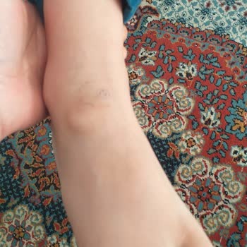 Decathlon'dan Alınan Havuz Paletleri Çocukların Ayaklarını Yaraladı