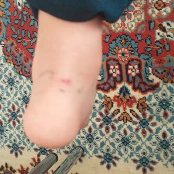 Decathlon'dan Alınan Havuz Paletleri Çocukların Ayaklarını Yaraladı