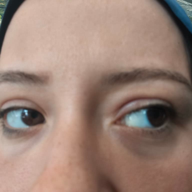 Kaş Kontürü Kabusu: Paramla Rezil Oldum