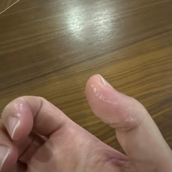 Vanish Kosla Leke Çıkarıcı Ellerimi Yaktı