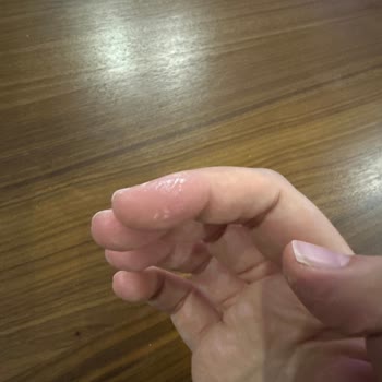 Vanish Kosla Leke Çıkarıcı Ellerimi Yaktı