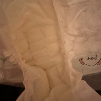 Bebek Bezi Doluluk Göstergesi Sorunu