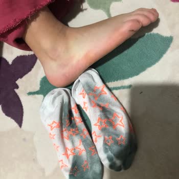 Derimod Botlarının Sağlık Riski Ve Boya Sorunu