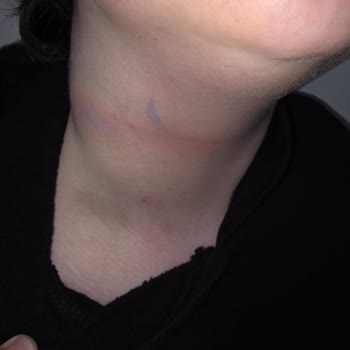 Açı Eğitim Kurumları Eğitim Yerine Şiddet: Okulda Güvenlik Ve Destek Arayışı