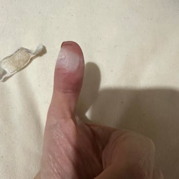 Getwell Yara Bandı: Suya Dayanıklılık Ve Nefes Alma İddiaları Hayal Kırıklığı Yarattı