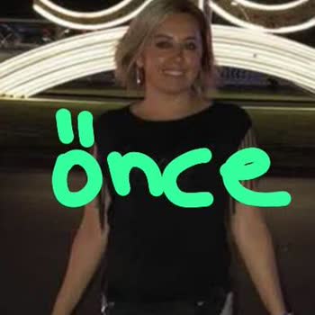 Estetik Operasyon Sonrası Hayal Kırıklığı