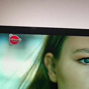 Philips TV'de Süregelen Ekran Sorunları Ve Değişim Talebi