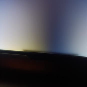 Onvo TV'de Reflektör Arızası Ve Destek Eksikliği