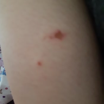 Trendyol Marjin Marka Botun Kalitesizliği Ve İade Sorunu