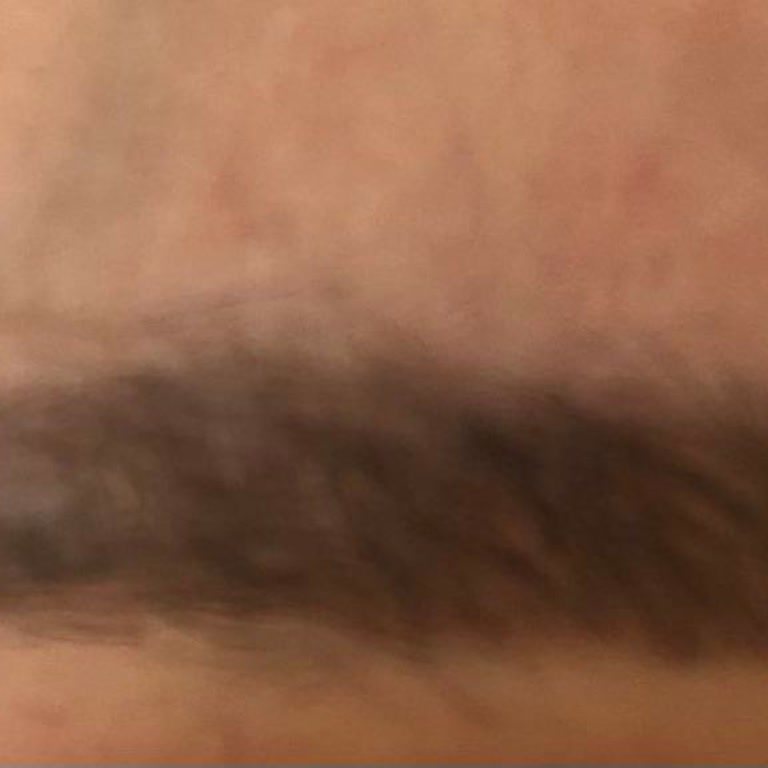 Tedavi Sonrası Ek Ücret Talebi