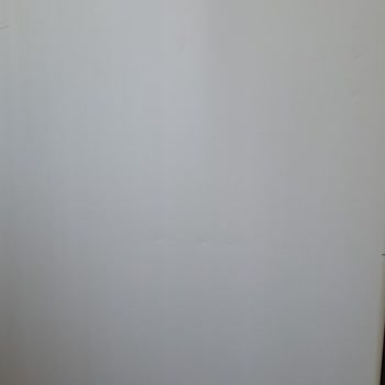 Derin Dondurucu Sorunları Ve Servis Deneyimi