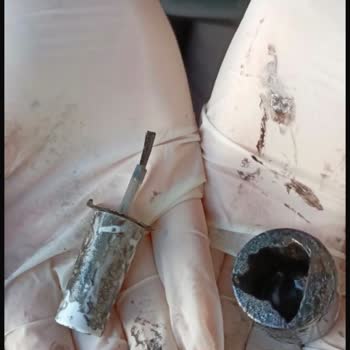 Kırık Oje Siparişi Ve Ulaşılmaz Müşteri Hizmetleri