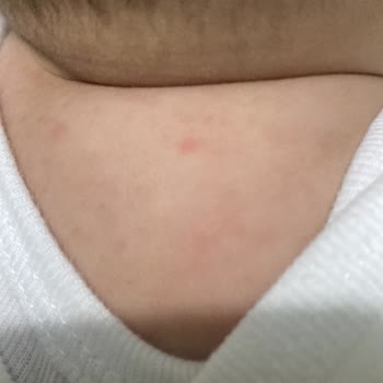 Bebeğime Uygulanan Yetersiz Tedavi Ve Yüksek Ücret