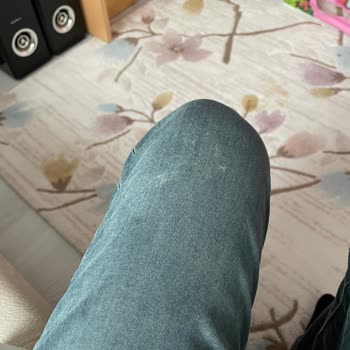 Lekeli Pantolon İadesi Veya Değişimi Hakkında Yardım Talebi