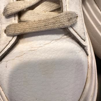 Adidas Ayakkabıda Üretim Hatası Ve Yetersiz İnceleme