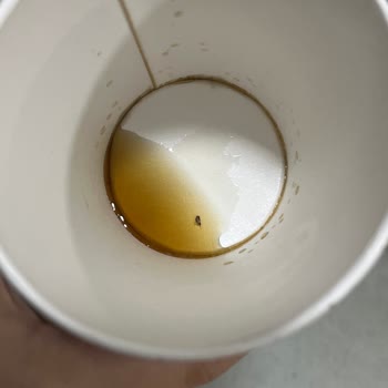 Kolanın İçinden Böcek Çıktı!